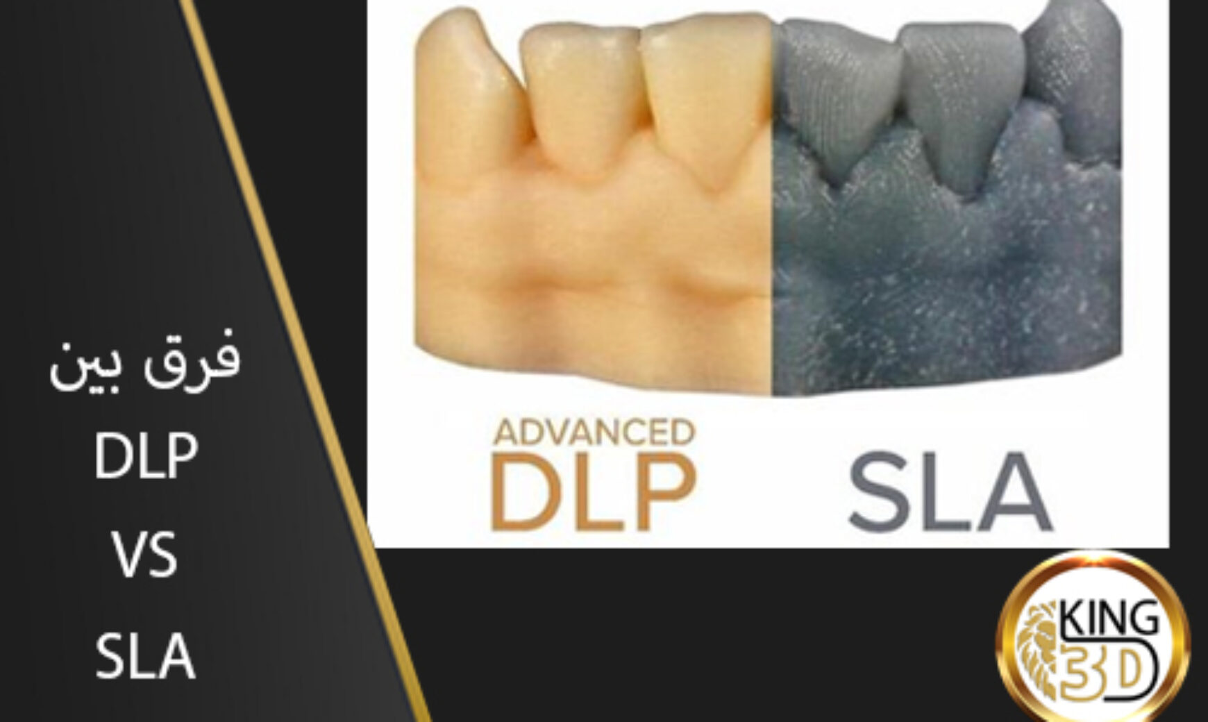 DLP VS SLA